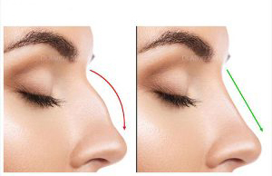 دسته بندی بینی ها 